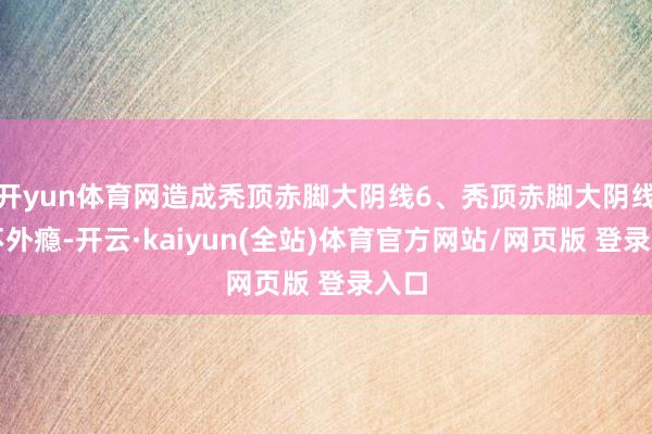 开yun体育网造成秃顶赤脚大阴线6、秃顶赤脚大阴线还不外瘾-开云·kaiyun(全站)体育官方网站/网页版 登录入口